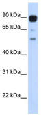Zinc Finger Protein 408 antibody, TA345399, Origene, Western Blot image 