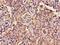 Glycoprotein IX Platelet antibody, LS-C670944, Lifespan Biosciences, Immunohistochemistry paraffin image 