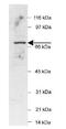 hPot1 antibody, GTX30601, GeneTex, Western Blot image 