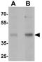 Mitochondrial Transcription Termination Factor 3 antibody, GTX32112, GeneTex, Western Blot image 