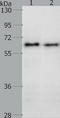 Cell division control protein 6 homolog antibody, TA321315, Origene, Western Blot image 
