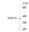 Vascular Endothelial Growth Factor D antibody, LS-C291743, Lifespan Biosciences, Western Blot image 