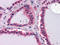 Laminin subunit beta-1 antibody, STJ98214, St John