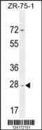 NADH:Ubiquinone Oxidoreductase Complex Assembly Factor 1 antibody, 55-386, ProSci, Western Blot image 
