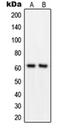 Growth Factor Receptor Bound Protein 14 antibody, orb214006, Biorbyt, Western Blot image 