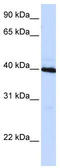 CCAAT Enhancer Binding Protein Beta antibody, TA344533, Origene, Western Blot image 