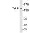 Non-receptor tyrosine-protein kinase TYK2 antibody, LS-C292257, Lifespan Biosciences, Western Blot image 