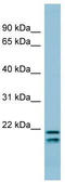 Pulmonary surfactant-associated protein C antibody, TA346095, Origene, Western Blot image 