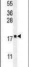 Dynein Light Chain Roadblock-Type 2 antibody, PA5-23763, Invitrogen Antibodies, Western Blot image 