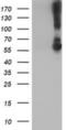 Potassium Voltage-Gated Channel Subfamily J Member 3 antibody, NBP2-01702, Novus Biologicals, Western Blot image 