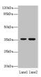 Eukaryotic Elongation Factor 2 Lysine Methyltransferase antibody, CSB-PA853420LA01HU, Cusabio, Western Blot image 