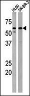 Protein Kinase, Membrane Associated Tyrosine/Threonine 1 antibody, PA5-12633, Invitrogen Antibodies, Western Blot image 