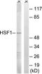 Heat Shock Transcription Factor 1 antibody, TA312874, Origene, Western Blot image 