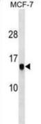 Histone Cluster 1 H2A Family Member M antibody, abx030416, Abbexa, Western Blot image 