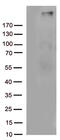 Complement Component 4B (Chido Blood Group), Copy 2 antibody, LS-C793166, Lifespan Biosciences, Western Blot image 