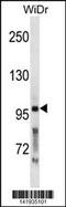Proprotein Convertase Subtilisin/Kexin Type 5 antibody, 60-811, ProSci, Western Blot image 