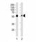 LYN Proto-Oncogene, Src Family Tyrosine Kinase antibody, F52444-0.4ML, NSJ Bioreagents, Western Blot image 