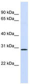 Fibroblast Growth Factor 14 antibody, TA335069, Origene, Western Blot image 