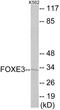 Forkhead Box E3 antibody, EKC1798, Boster Biological Technology, Western Blot image 