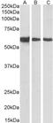 Desmin antibody, STJ71803, St John
