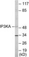 Inositol-Trisphosphate 3-Kinase A antibody, EKC1693, Boster Biological Technology, Western Blot image 