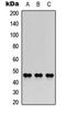 Collagen Like Tail Subunit Of Asymmetric Acetylcholinesterase antibody, LS-C354263, Lifespan Biosciences, Western Blot image 