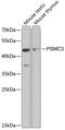 Proteasome 26S Subunit, ATPase 3 antibody, GTX55764, GeneTex, Western Blot image 