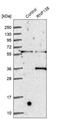 Stage-Specific Embryonic Antigen 5 antibody, NBP1-86987, Novus Biologicals, Western Blot image 