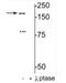 Glutamate Ionotropic Receptor NMDA Type Subunit 2B antibody, NB300-182, Novus Biologicals, Western Blot image 