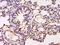 Polypeptide N-Acetylgalactosaminyltransferase 13 antibody, orb157032, Biorbyt, Immunohistochemistry paraffin image 