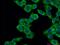 Lactamase Beta antibody, 18195-1-AP, Proteintech Group, Immunofluorescence image 