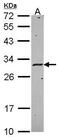 Major Histocompatibility Complex, Class II, DM Alpha antibody, PA5-22365, Invitrogen Antibodies, Western Blot image 