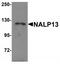 NLR Family Pyrin Domain Containing 13 antibody, TA320091, Origene, Western Blot image 