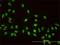 A-Kinase Anchoring Protein 8 antibody, H00010270-M01, Novus Biologicals, Immunofluorescence image 
