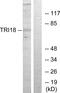 Midline 1 antibody, PA5-38524, Invitrogen Antibodies, Western Blot image 