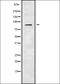 ADAM Metallopeptidase Domain 30 antibody, orb337961, Biorbyt, Western Blot image 