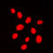 Tumor Protein P53 Binding Protein 1 antibody, LS-C354111, Lifespan Biosciences, Immunofluorescence image 