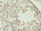 ADAM Metallopeptidase With Thrombospondin Type 1 Motif 12 antibody, orb20798, Biorbyt, Immunohistochemistry paraffin image 