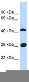 Cilia And Flagella Associated Protein 299 antibody, TA329793, Origene, Western Blot image 