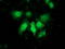 Phenylethanolamine N-methyltransferase antibody, LS-C172945, Lifespan Biosciences, Immunofluorescence image 