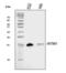 Interferon Induced Transmembrane Protein 1 antibody, A02633-2, Boster Biological Technology, Western Blot image 