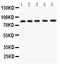 Amyloid Beta Precursor Like Protein 1 antibody, PB9476, Boster Biological Technology, Western Blot image 
