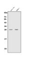Cyclin-dependent kinase 2-interacting protein antibody, A07687-1, Boster Biological Technology, Western Blot image 