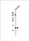 Lactalbumin Alpha antibody, PA5-71919, Invitrogen Antibodies, Western Blot image 