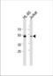 RUNX Family Transcription Factor 3 antibody, TA324560, Origene, Western Blot image 
