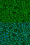 Drosha Ribonuclease III antibody, 23-518, ProSci, Immunofluorescence image 