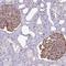 Apoptosis Resistant E3 Ubiquitin Protein Ligase 1 antibody, HPA051306, Atlas Antibodies, Immunohistochemistry paraffin image 