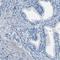 Xin Actin Binding Repeat Containing 1 antibody, HPA018458, Atlas Antibodies, Immunohistochemistry frozen image 