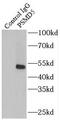Proteasome 26S Subunit, Non-ATPase 5 antibody, FNab06891, FineTest, Immunoprecipitation image 