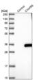 Chromosome X Open Reading Frame 56 antibody, PA5-58468, Invitrogen Antibodies, Western Blot image 